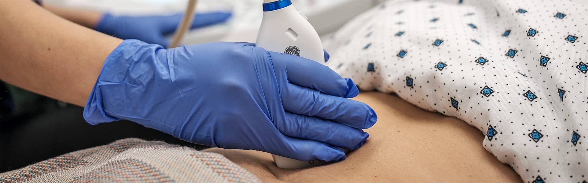 Echographie abdominopelvienne